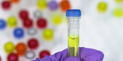 Laboratory tube with enzyme reagent
